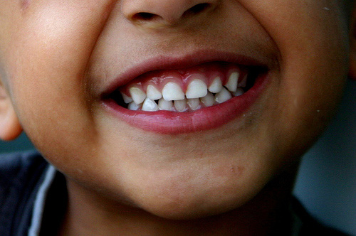 Sorriso di un bambino